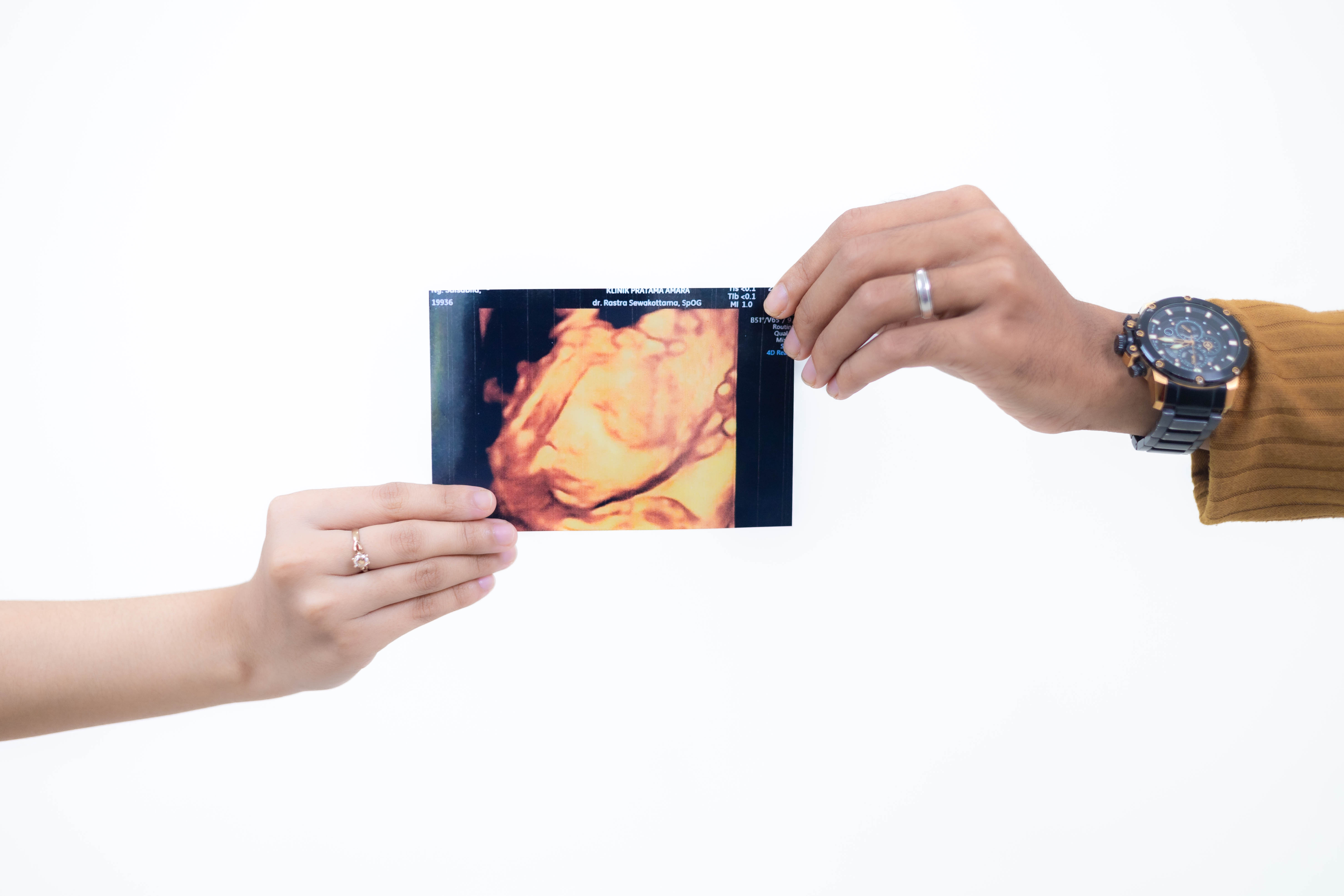 Maternity